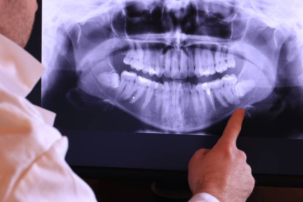 Best Emergency Treatment for Dental Infections or Abscesses in Dennis Port, MA
